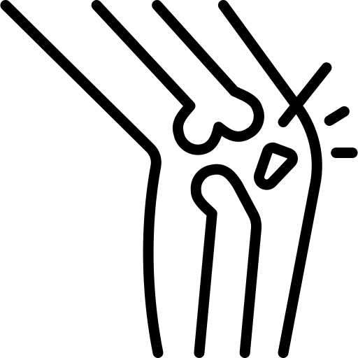 Illustration of knee dislocation